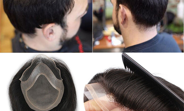 hair replacement systems