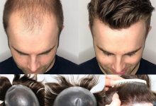 hairpieces for men