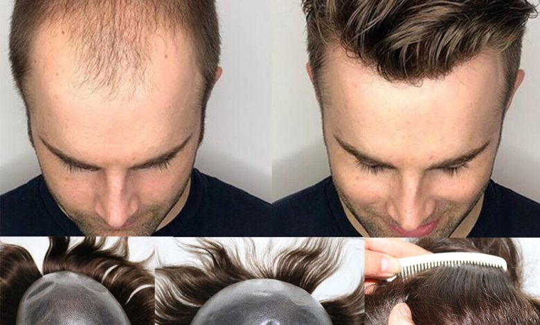 hairpieces for men
