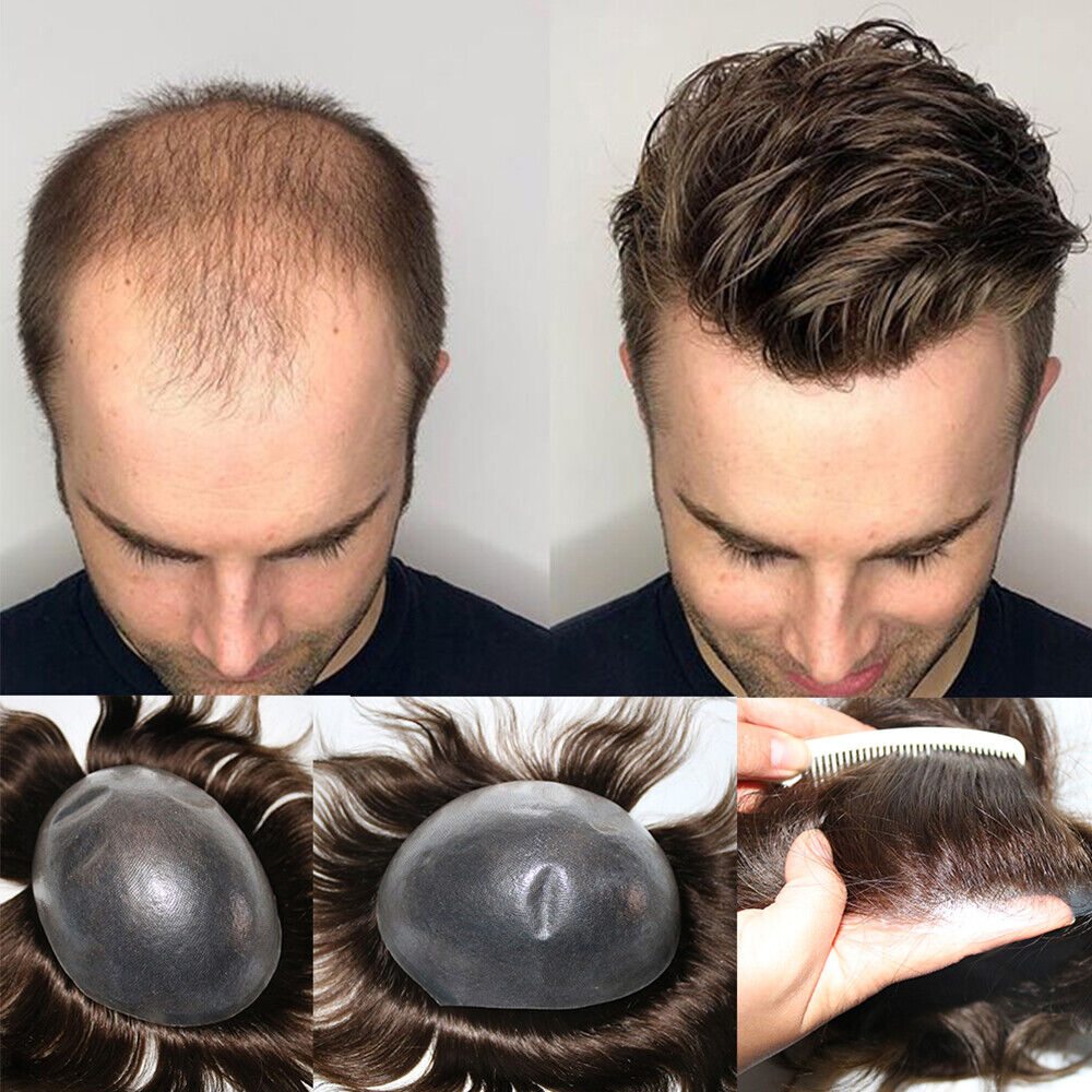hairpieces for men