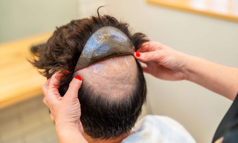 hairpieces for men