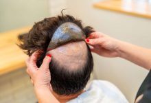 Hair Systems for Men Online