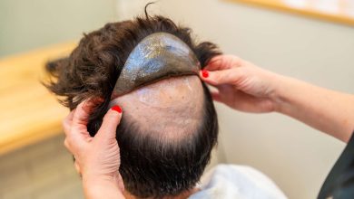 Hair Systems for Men Online